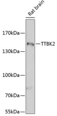 Western Blot: Tau tubulin kinase 2 AntibodyBSA Free [NBP2-93385]